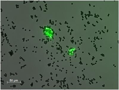 Circulating Endothelial Cells as Promising Biomarkers in the Differential Diagnosis of Primary Angiitis of the Central Nervous System